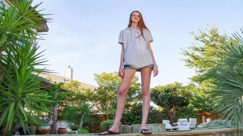 Guinness World Record for the youngest girl in the world with the longest legs