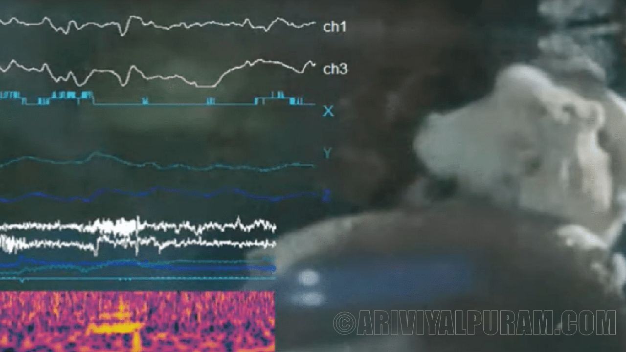 Octopus Brain Wave