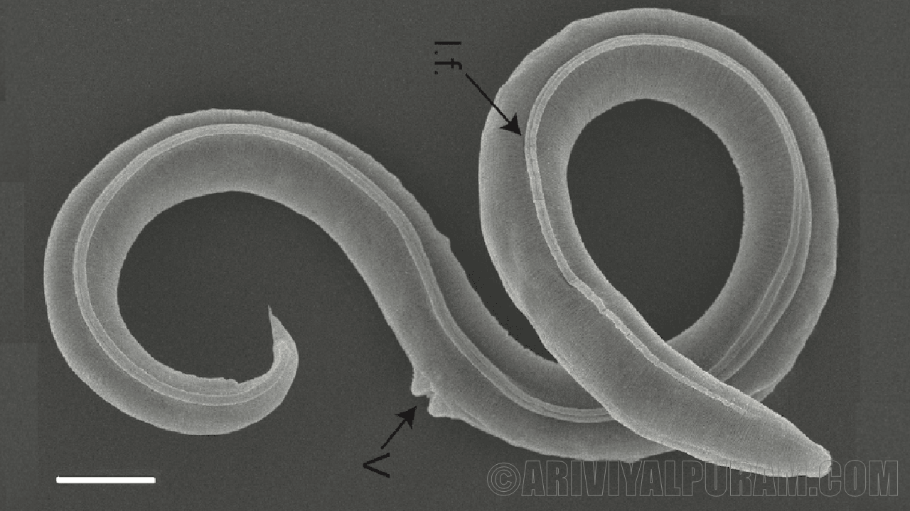 Genetic methods for roundworms 