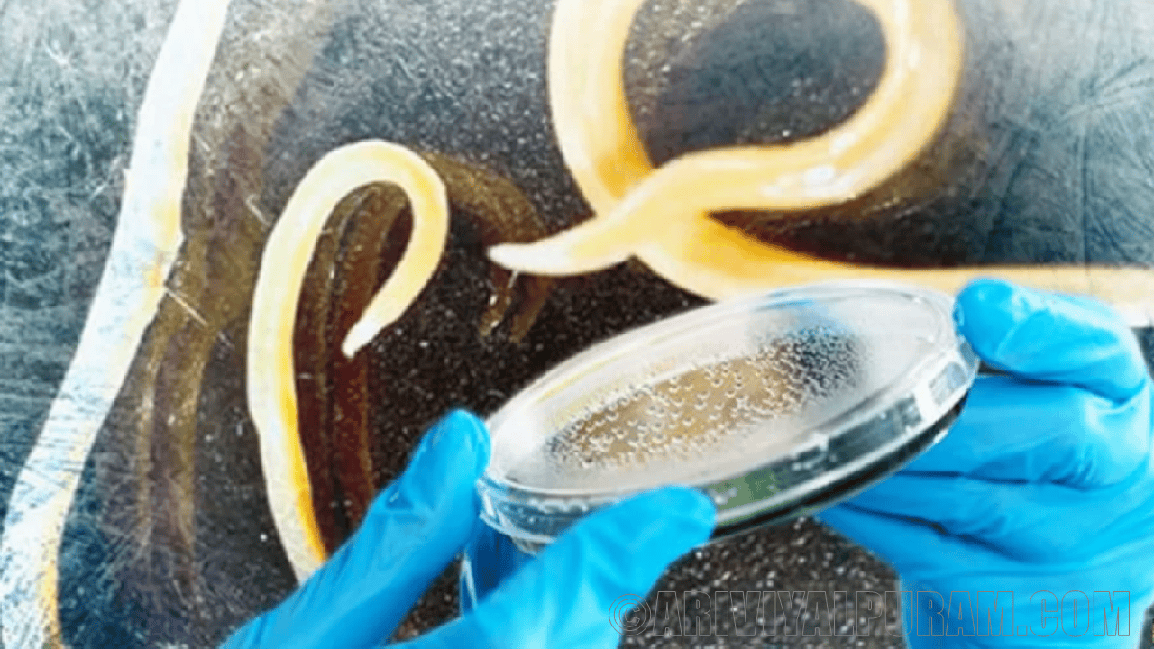 Genetic methods for roundworms 