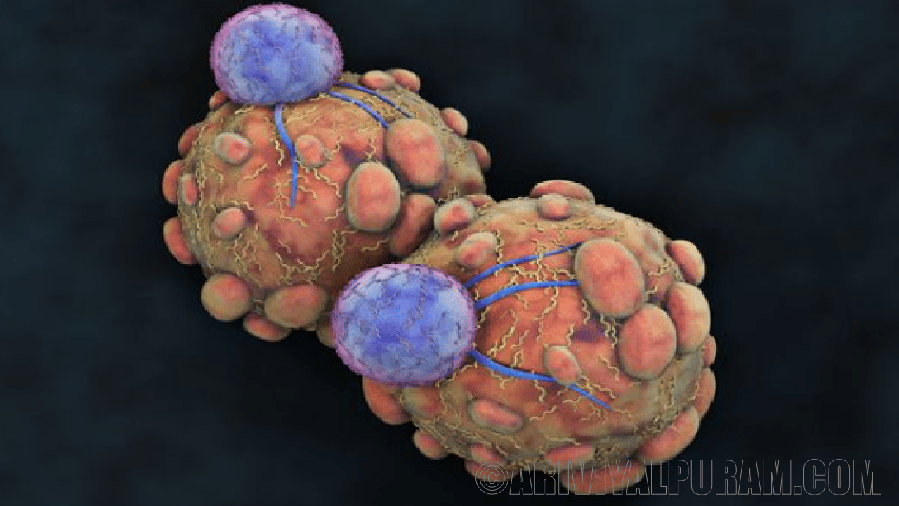 Gene expression in tumors