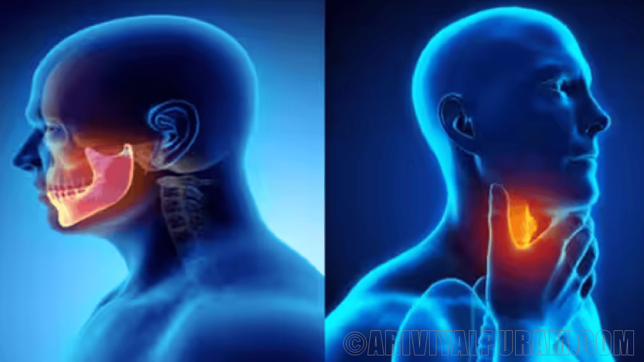 Gene expression in tumors